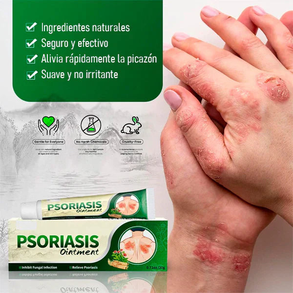 2x1 | Crema Antifúngica y Antipicazón Jinyue – Tratamiento Natural para Tiña, Hongos y Psoriasis | 20g