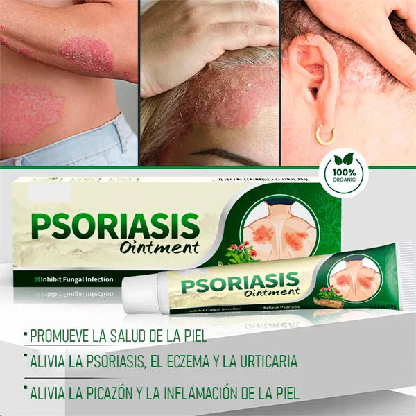 2x1 | Crema Antifúngica y Antipicazón Jinyue – Tratamiento Natural para Tiña, Hongos y Psoriasis | 20g