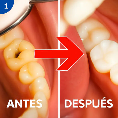 LapizDental 🦷 Beamach® | Regenera tus Dientes Desde Casa y Dile Adiós a la Sensibilidad